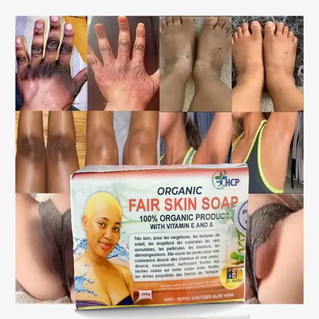 Organic Fair Skin Soap flyer with results